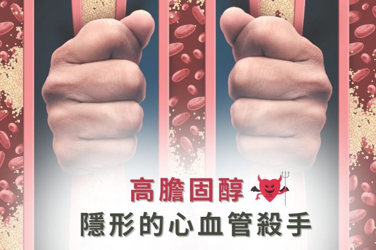 高膽固醇隱藏心血管危險，強烈影響健康，需及早預防與治療。
