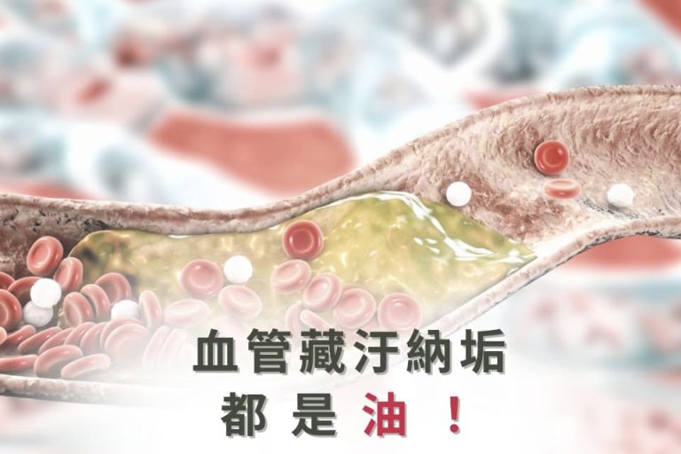 血管內部積聚的油脂物質。