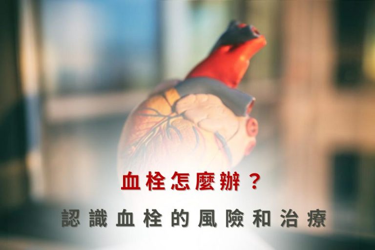 血管怎麼辦？認識血管的風險和治療。